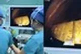 Bé gái 5 tuổi nuốt thỏi vàng 50gr, các bác sĩ nội soi gắp thành công