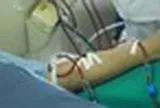 Nhiều người mới 18, 20 tuổi mà thận đã suy teo: Bác sĩ BV 108 chỉ ra triệu chứng cần đi khám sớm