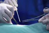 Cụ bà 74 tuổi vào viện phẫu thuật chân phải, bác sĩ cắt nhầm chân trái