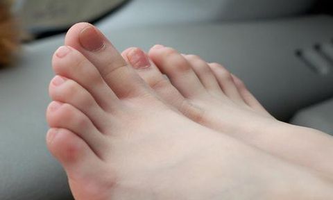 Người sống thọ thường có 2 đặc điểm trên bàn chân, ai có rồi càng nên biết trân trọng sức khỏe
