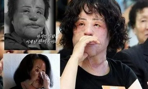 Bi kịch của biểu tượng nhan sắc Hàn hủy hoại cuộc đời vì phẫu thuật thẩm mỹ