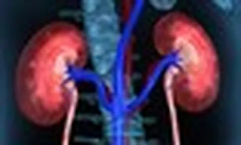 1 thói quen của nhiều người Việt khiến 2 quả thận "lâm nguy", bác sĩ cũng phải lắc đầu