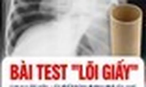 BS chuyên khoa Nhi tiết lộ: Chỉ bằng bài kiểm tra với lõi giấy vệ sinh, cha mẹ có thể ngăn con hóc dị vật