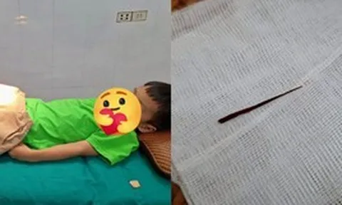 Con trai chịu đau cả buổi chiều không dám báo cô: Bố mẹ đưa đi viện mới lo lắng với chiếc dằm rút ra từ đùi con