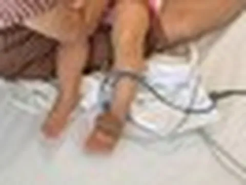 Mẹ chia sẻ bài học xương máu khi con bị sốc phản vệ khi truyền dịch: "Không ngờ mạng sống của con có lúc chỉ còn tính bằng phút"