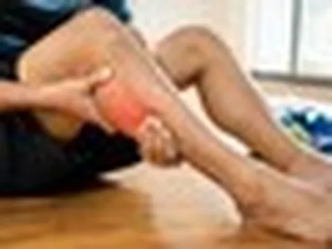 Rướn người cứu bóng pickleball, tưởng căng cơ, chàng trai rách cơ bắp chân