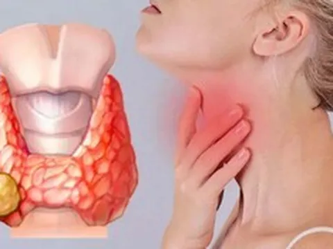 Có những biểu hiện này, đừng chủ quan vì có thể là dấu hiệu ung thư