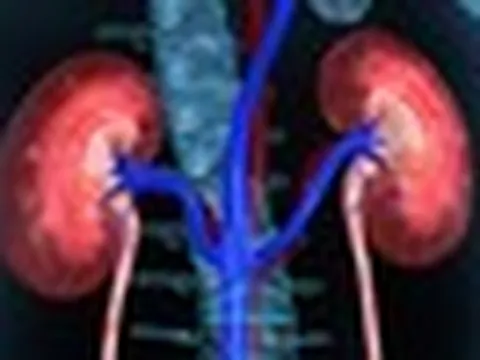 1 thói quen của nhiều người Việt khiến 2 quả thận "lâm nguy", bác sĩ cũng phải lắc đầu