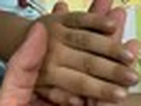 Bé trai 3 tuổi mặt "đổi màu", suýt chết sau khi ăn thức ăn thừa: Hãy vứt bỏ những loại thức ăn này ngay lập tức