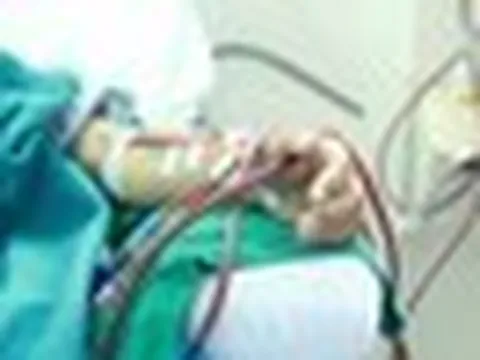 21 tuổi, không có triệu chứng nhưng đã suy thận giai đoạn 4: Bác sĩ BV 108 tìm ra “thủ phạm”
