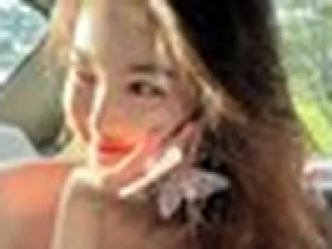 Nếu 3 nơi này trên cơ thể không thâm đen, xin chúc mừng vì thận của bạn vẫn khỏe mạnh!